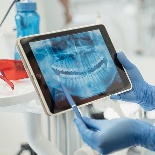 Periodoncia en Castelldefels
